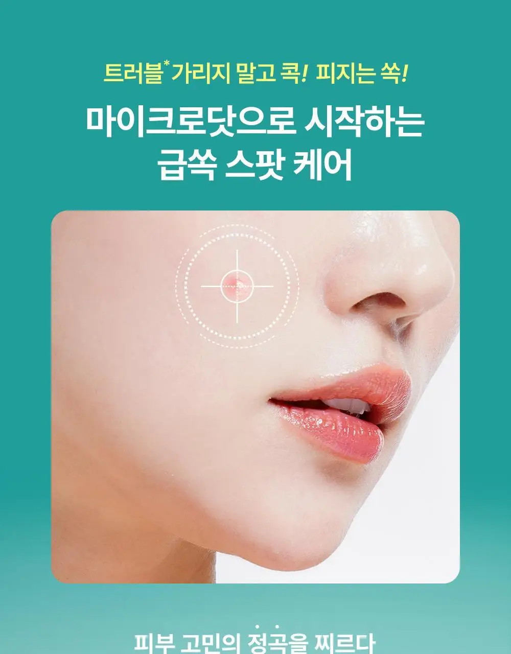[리뉴얼] 니들리 스팟 클리어 12패치 1+1 기획 (12+12패치) 상세페이지 10